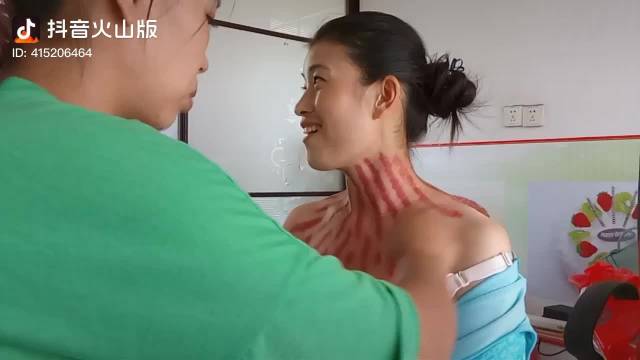 揪痧视频，古老传统疗法的现代展现